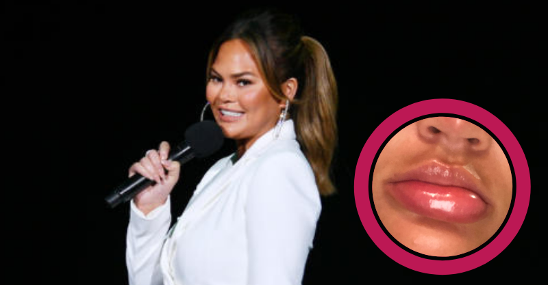 chrissy teigen header