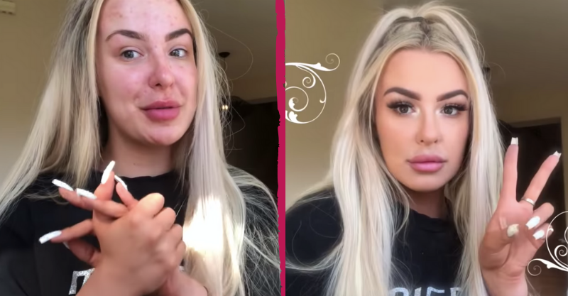 tana mongeau before_after