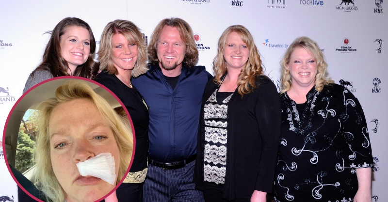 sisterwives janelle brown skin cancer